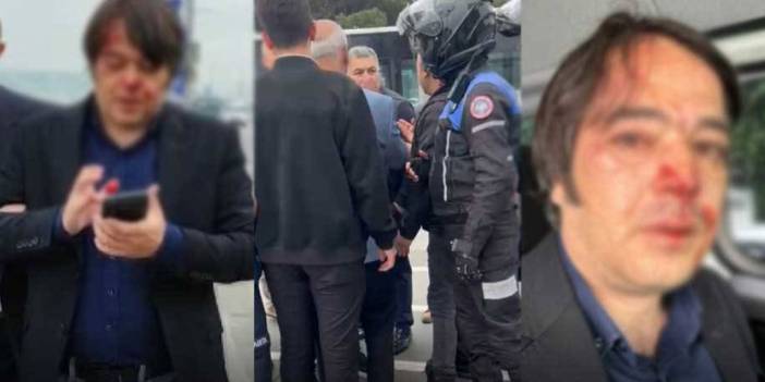 İBB ekiplerine saldırıda üç kişiye gözaltı