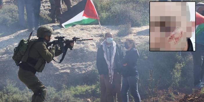 İsrail polisi şiddette sınır tanımıyor: Filistinli gencin yüzüne Davud Yıldızı kazıdılar