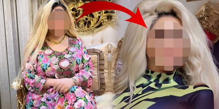 Barbie'ye benzemek için 43 kez ameliyat oldu ama hiç kimseye benzemedi! Yine de tatmin olmadı, tekrar bıçak altına yatacak