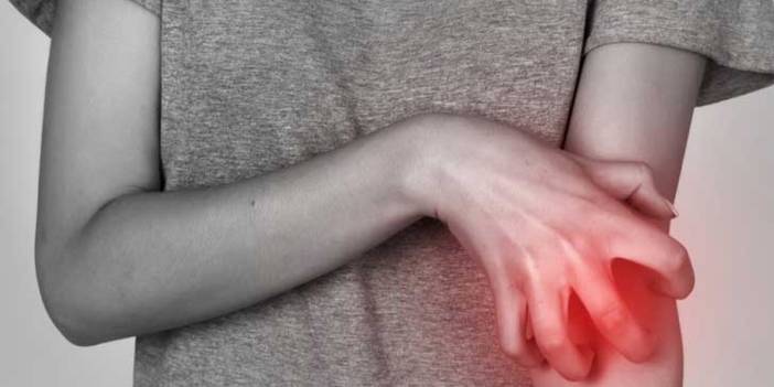 Uyuz hastalığındaki hurafelere uzmanlardan yanıt: Hayvandan insana bulaşır mı?