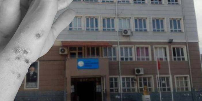 Deprem bölgesinde 'uyuz' tehdidi: Öğrenciler arasında hızla yayılıyor