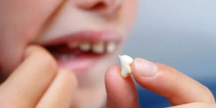 Rüyada Dişinin Düştüğünü Görmek: Anlamı ve Yorumları
