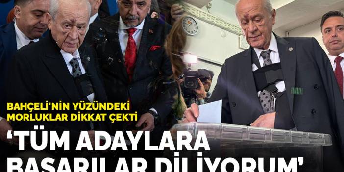 Bahçeli'nin yüzündeki morluklar dikkat çekti: Adaylara başarılar diliyorum