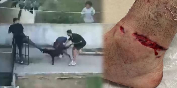 Pitbull dehşeti kamerada: Ayağım koptu zannettim! Pitbull'un sahibi, köpek sahipsiz gibi numara yaptı