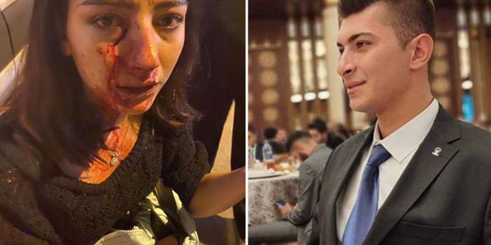 AK Parti ilçe gençlik kolları başkanından genç kadına yumruklu saldırı: 'Nasıl vurdum kıza'