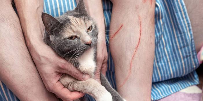 Beslediği kedisi tırmalayan adam kısmi kör oldu! Meğer sokaktan o bakteriyi eve taşımış