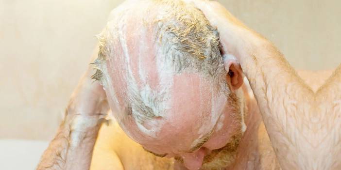 O kentte yaşayanlara şok: Kel kalabilirsiniz! Bu şampuanı kullananlara geçmiş olsun