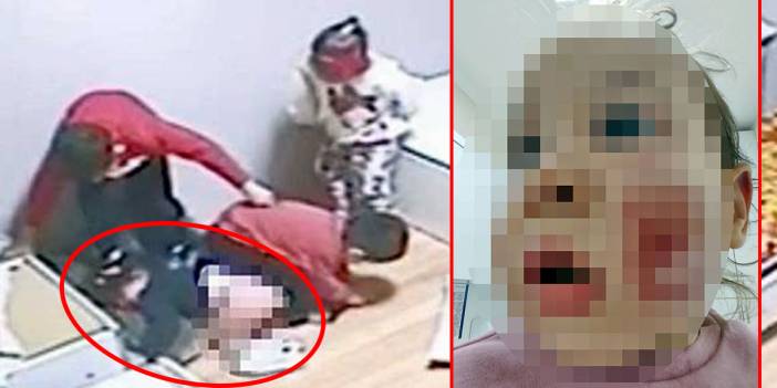 2 yaşındaki kız çocuğunun yüzünü parçaladılar! Özel kreşte kan donduran akran zorbalığı kamerada