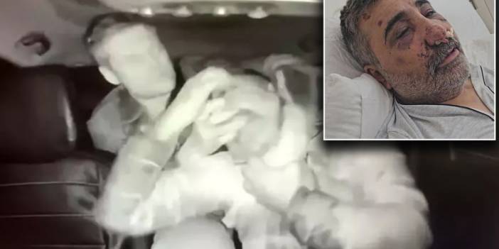 İngiliz boksörün darbettiği taksici konuştu: Öptü, ısırdı, elini gözüme soktu
