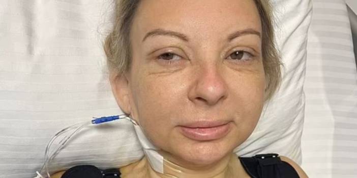 Estetik ameliyat olduğuna pişman oldu: Hayal kırıklığıyla yaşıyor: Keşke hiç kalkışmasaydım