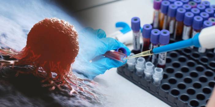 Bilim insanlarından yeni çalışma! Kanser teşhisinde ultra hassas kan testi: Teşhisten 3 yıl öncesine kadar tespit edilebiliyor