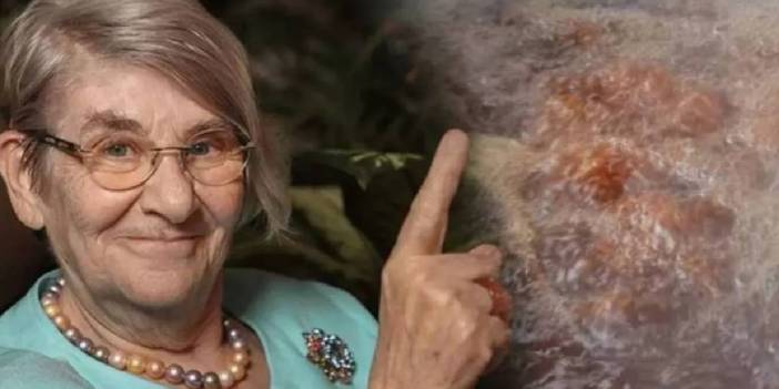 Canan Karatay şifanın formülünü verdi! Bu ikiliyi birlikte tüketin: Damarları temizliyor, yaşlanmayı geciktiriyor…