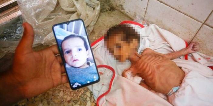 Gazze sözün bittiği noktada: Bebekler açlıktan ölüyor