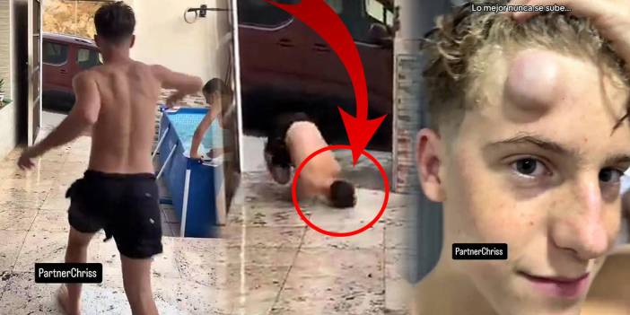 Havuz macerası kötü bitti: Kafasında dev bir yumurta çıktı! Dikkatsizlik pahalıya patladı