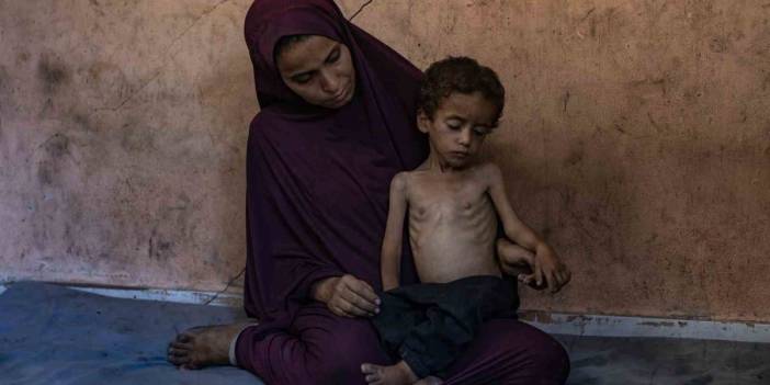 Gazze’de açlık nedeniyle can kaybı 113’e yükseldi