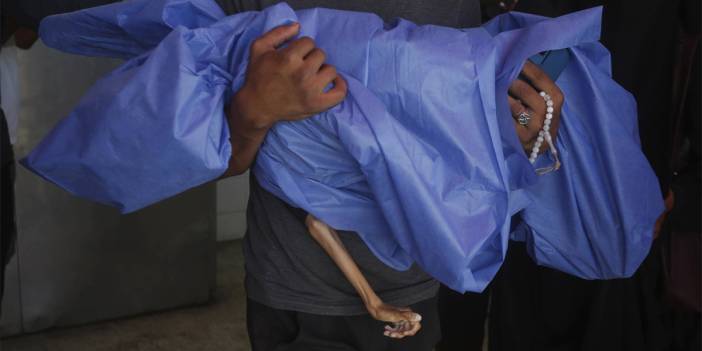 Gazze'de 10 yaşındaki çocuk açlıktan öldü! 'Batıda olsa kıyamet kopardı'