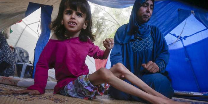 Açlık insan vücudunu nasıl etkiler? BM'den Gazze için açlık uyarısı