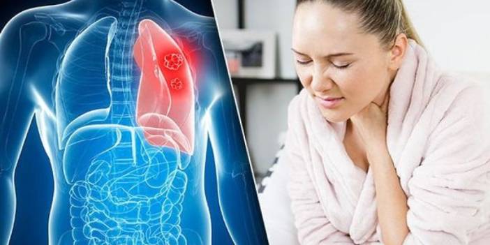 Akciğer kanserinin ekonomiye yükü 129 milyar TL