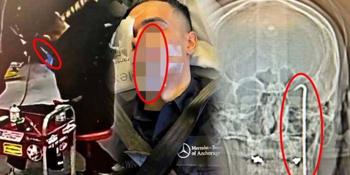 Tornavida gözünden girip kafasına saplandı! İş kazası kamerada