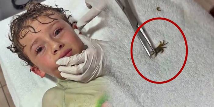 Akla ziyan olay! Kulağından yengeç çıktı