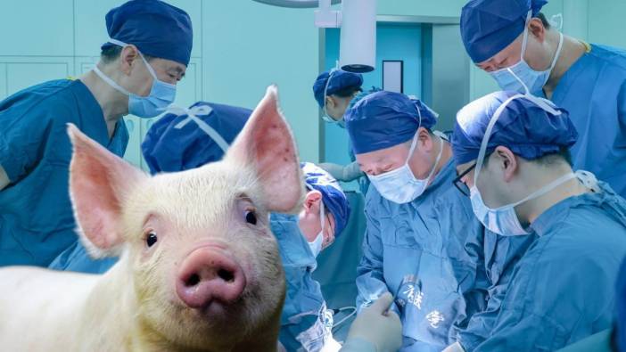 Dünyada bir ilk! Domuz karaciğeri yaşayan bir insana nakledildi