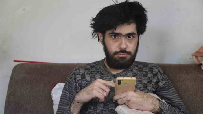 23 yaşındaki genç depremden sonra kendini eve kapattı! 3 yıldır banyo yapmıyor, tırnaklarını kesmiyor