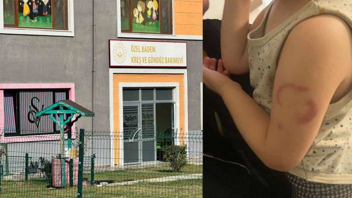 Öğretmenden 'çocuğun kolunu ısırdı' iddiasına akılalmaz savunma: Öperken oldu