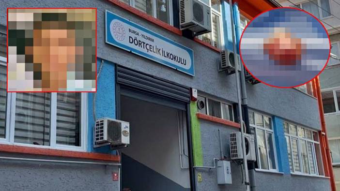 Akılalmaz ihmal iddiası! Öğrencinin parmağı koptu, öğretmen derse devam etti