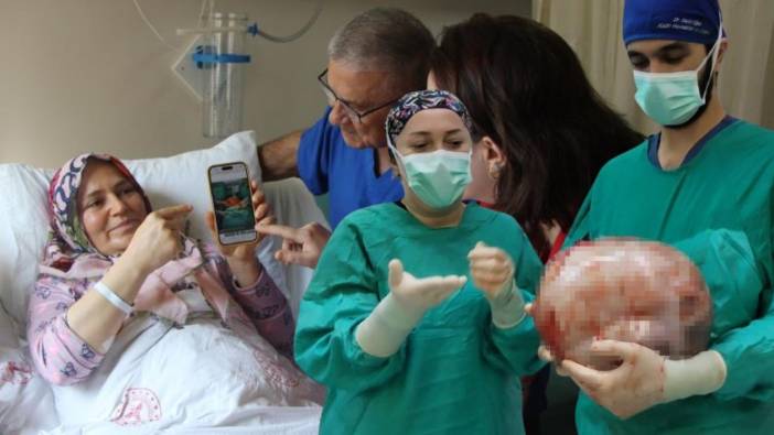 Karnı 9 aylık hamile gibi büyüdü, doktora gidince şok oldu! 8,5 kilo kitle çıkarıldı