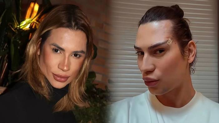 Göz alıcı bakışlar istedi, hayatını kaybetti! Ünlü fenomen, fox eyes uğruna öldü