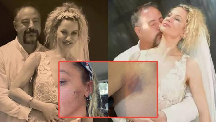 Şiddet gördüğünü söyleyen Yıldız Asyalı'dan şok iddialar! Asyalı canlı yayında yaşadıklarını anlattı