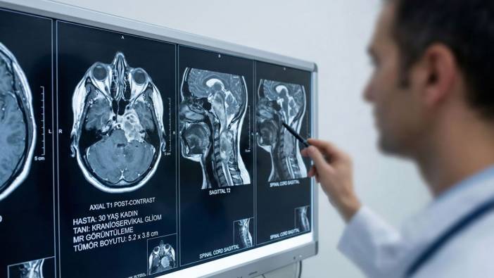 Uçakta başlayan çift görme meğer ölümcül hastalığın habercisiymiş!