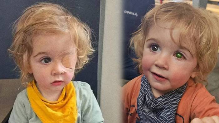 Dudağı uçuklu tanıdığı tarafından öpülen çocuk, görme yetisini kaybetti!