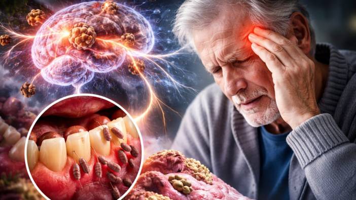 Alzheimer hakkında ezber bozan keşif! Diş eti bakterileri beyni tehdit ediyor