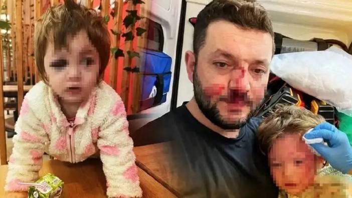 Yalova'da 14 aylık bebek ve babasına saldırı: İçişleri Bakanlığı olayla ilgili müfettiş görevlendirdi