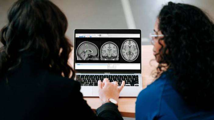 Alzheimer araştırmasında umut veren gelişme: Hasarı azaltan protein keşfedildi