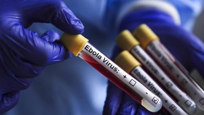 Ebola salgınında tarihi adım: Yeni aşı dünyada ilk kez insanda denendi