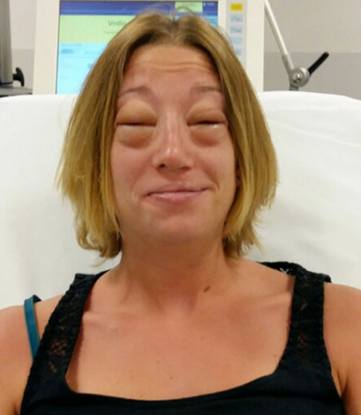 esek-sutunde-olum-riski-8227-dhaphoto6-1-001