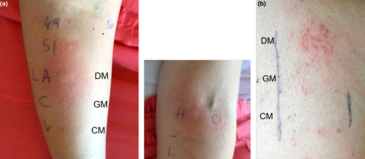 esek-sutunde-olum-riski-8227-dhaphoto7-001