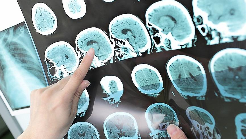 ms-shutter-16-9-1590759280