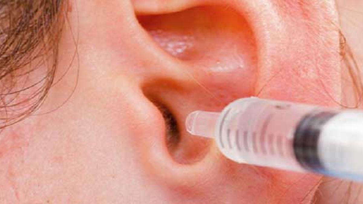 Прочистить пробки в ушах в домашних условиях. Промывание ушных пробок. Промывание ушей от серных пробок. Шприц для вымывания пробок из ушей.