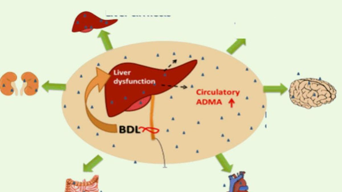 coklu-organ-yetmezligi-nedirr
