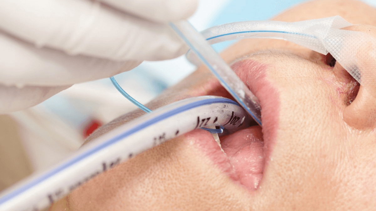 aspirasyon-nedir-1-001