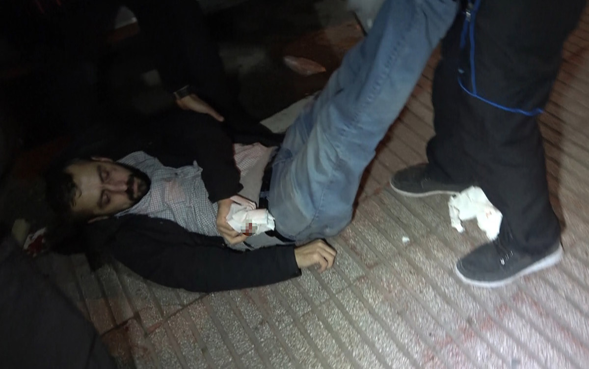 dha-muhabirine-cirkin-saldiri-kisitlamayi-ihlal-eden-boksor-gazetecinin-burnunu-kirdi-5500-dhaphoto4