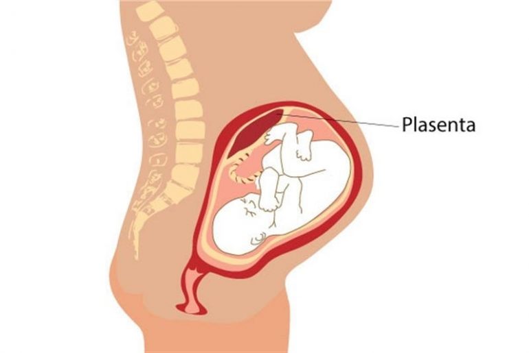 plasenta-770x515