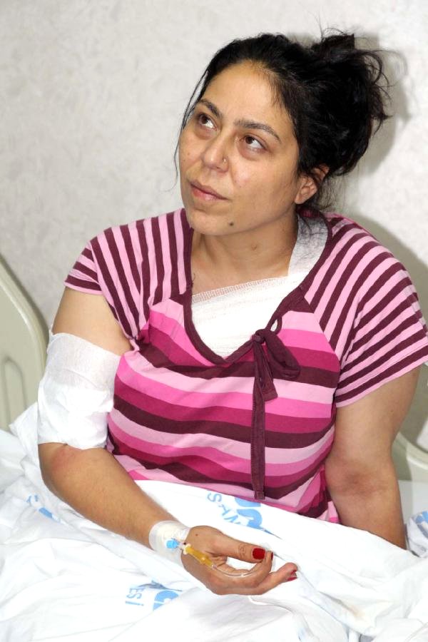 suruc-ta-yaralanan-hdp-li-patlama-anini-anlat-7528082-x-o