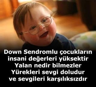 down-sendromu-3