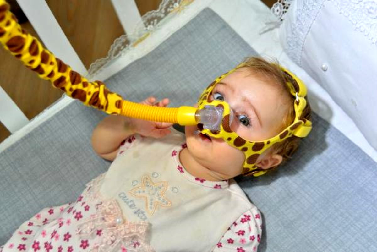 sma nedir nasil anlasilir iste sma hastaligi belirtileri