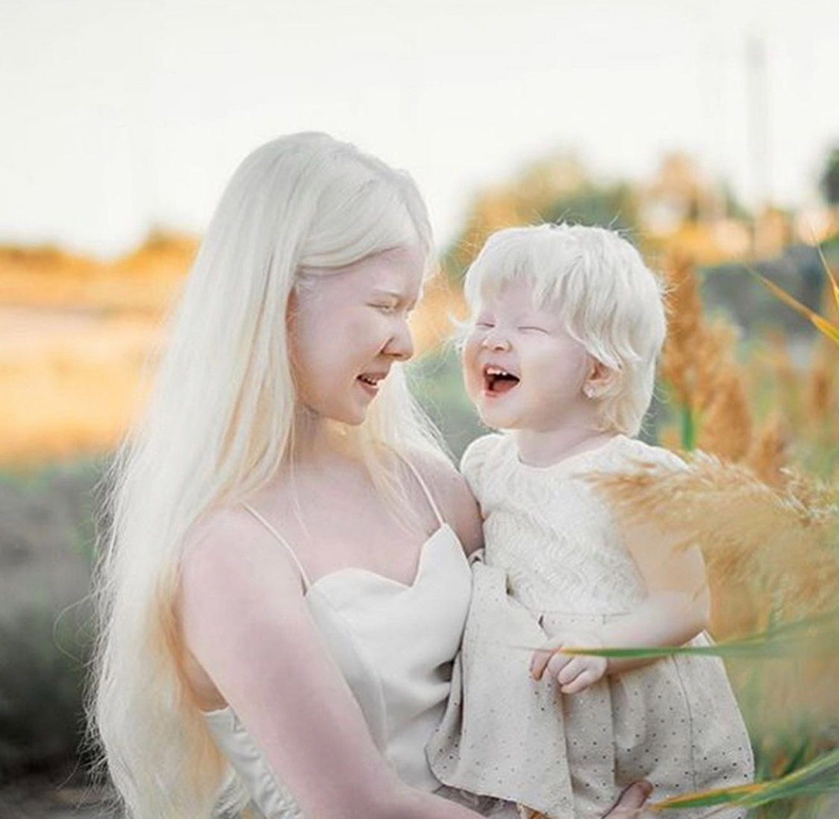 Как люди рождаются альбиносами. Сестры альбиносы из Казахстана. Сестры Калагановы альбиносы.