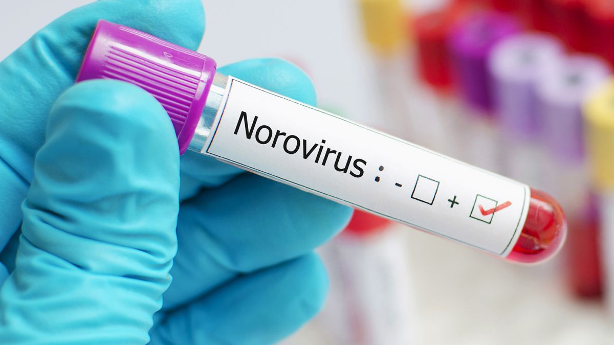 noravirus
